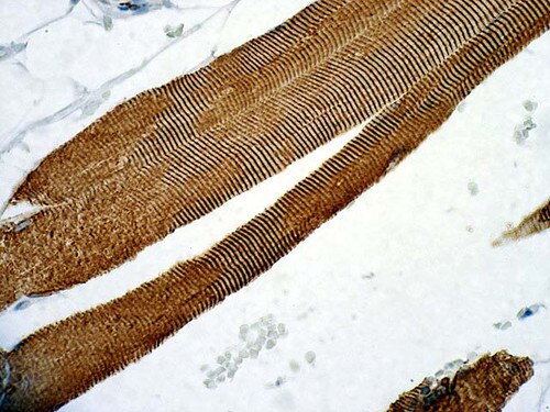 IHC of Desmin on an FFPE Skeletal Muscle Tissue